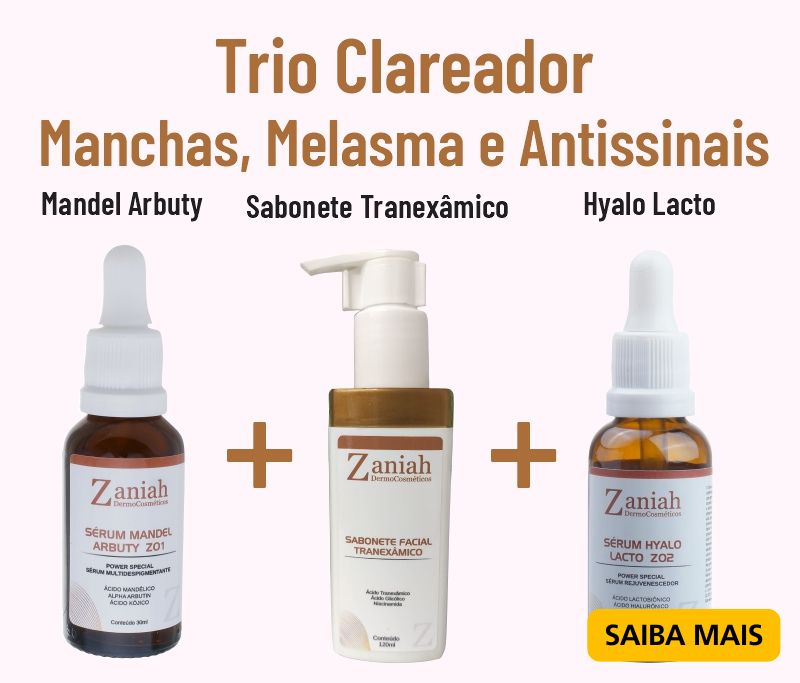 melasma tratamento ácido