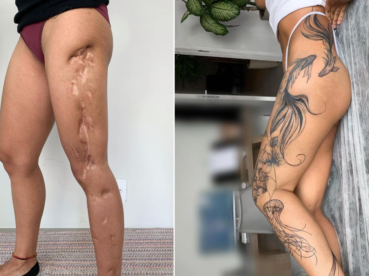 tatuagem e saúde