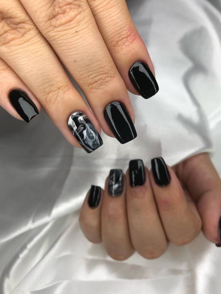 melanoma ungueal